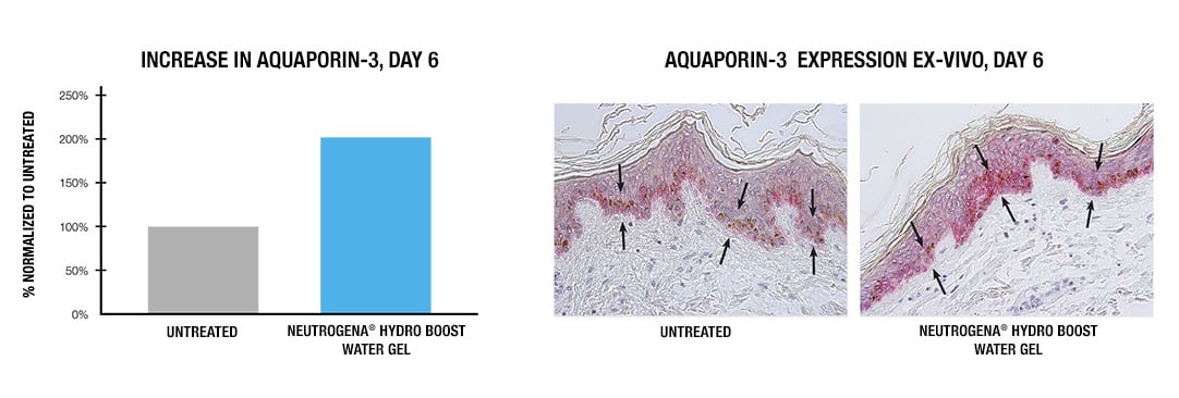 Ex-vivo model showed significant increase in Aquaporin-3