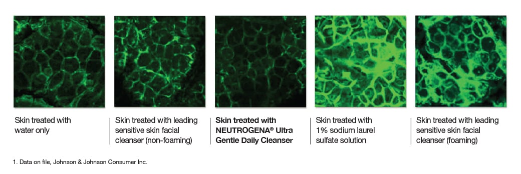 Fluorescent microscopy images of preservation of the lipid barrier