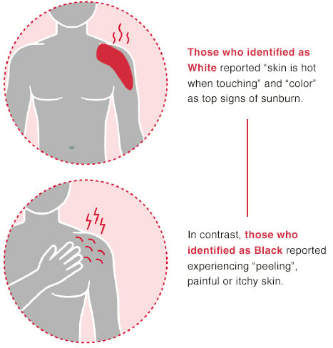 Those who identified as White reported “skin is hot when touching” and “color” as top signs of sunburn. In contrast, those who identified as Black reported experiencing “peeling”, painful or itchy skin.