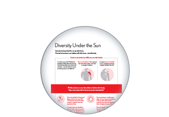 Sunburn Experiences Across Ethnicities Icon