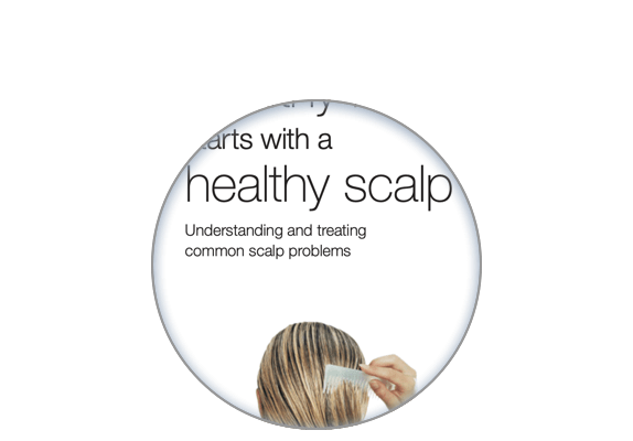 Image of the site on the healthy scalp patient brochure
