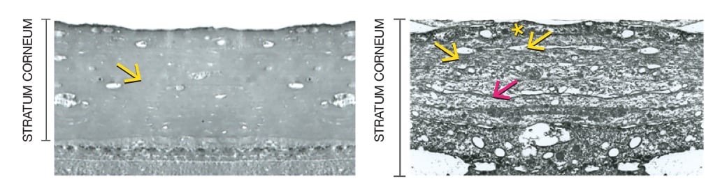 Stratum corneum of living skin model compared image